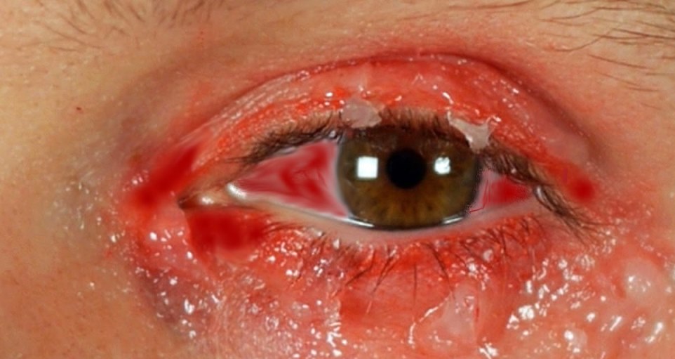 eye